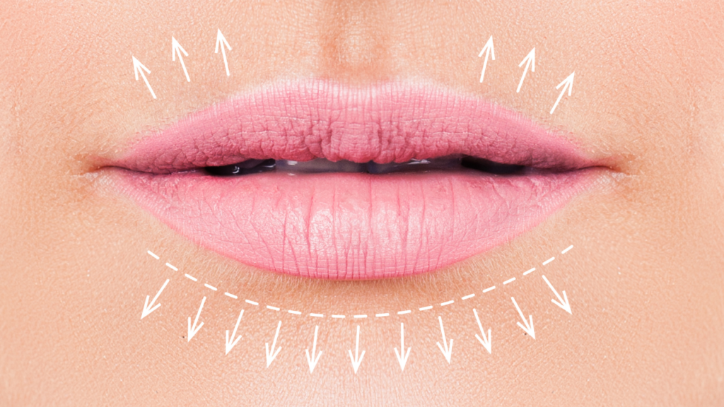 Clos up of lips with lines where lip lines can form