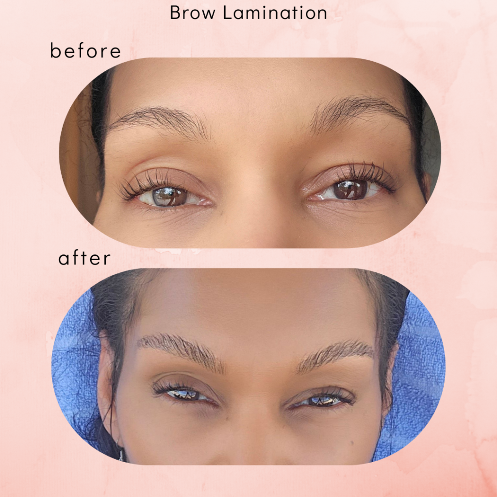 before and after results of brow lamination